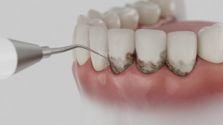Reliable Dental contractor in Indio, CA by Smile Center Dentistry